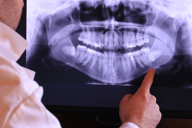 Best Holiday Emergency Dentist in West Cape May, NJ