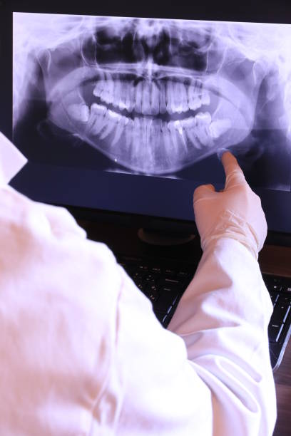 Best Emergency Dentist for Knocked-Out Tooth in West Cape May, NJ