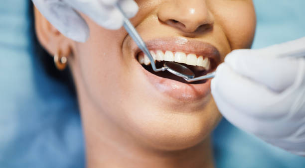 Best Emergency Dental Extractions in West Cape May, NJ