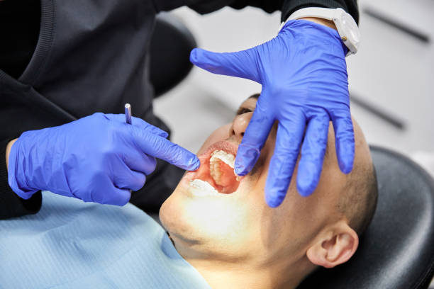 Best Broken or Cracked Tooth Emergency Dentist in West Cape May, NJ