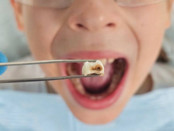 Best Orthodontic Emergency Dentist in West Cape May, NJ